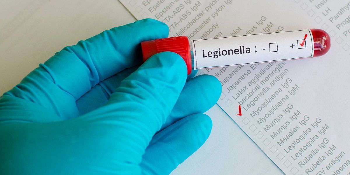 https://golfindustria.es/wp-content/uploads/2021/11/legionella-56g.jpg